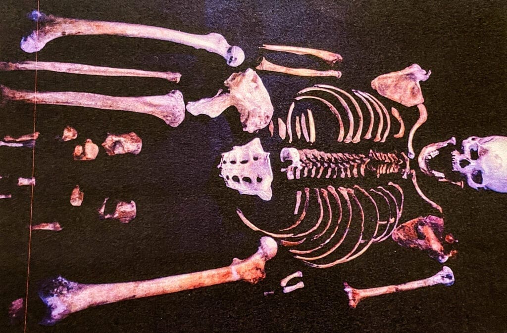 A photo of a skeleton.