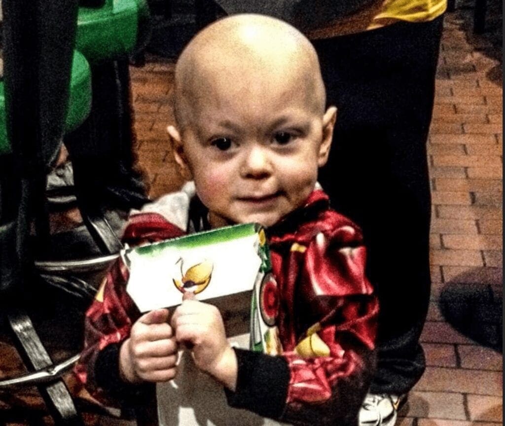 A young child who is bald.