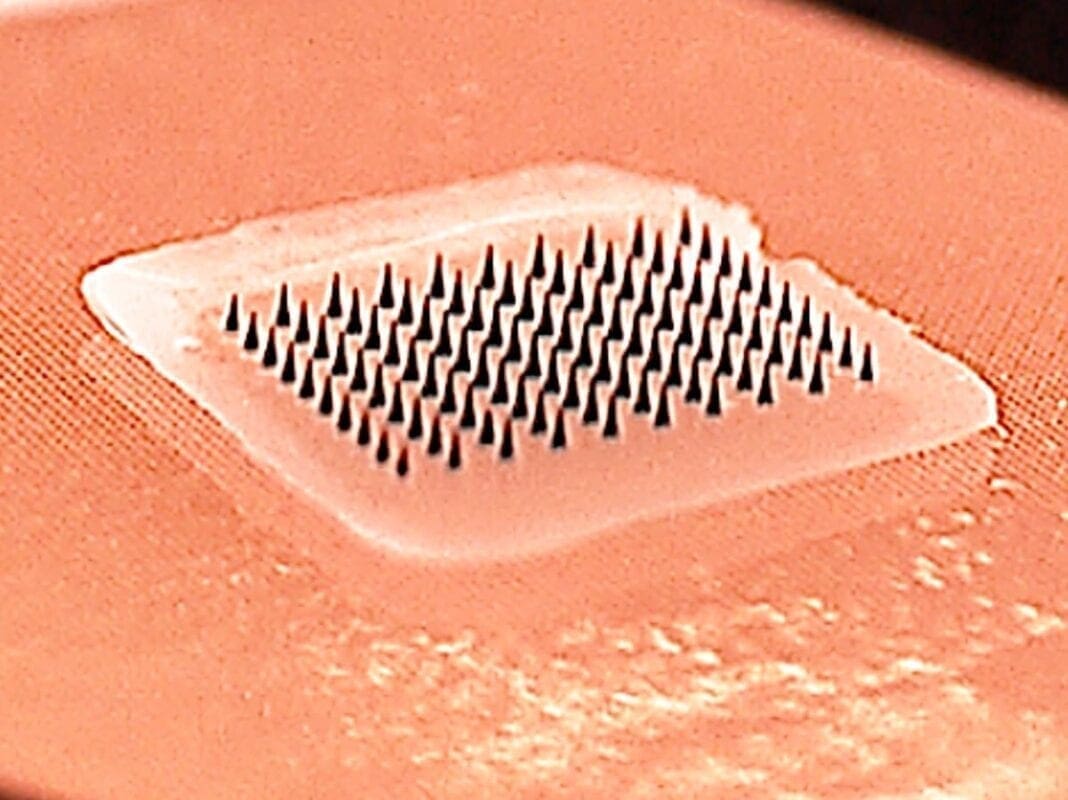 An image of a possible microneedle vaccine patch.